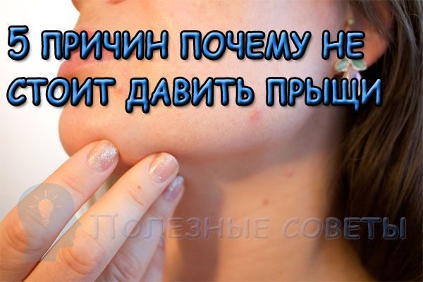 Почему не стоит давить прыщи